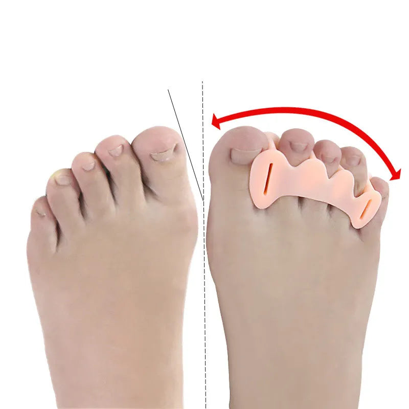 Toe Spacers - Peach